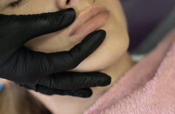 Kvinde modtager skønhedsbehandling med ansigtsfiller